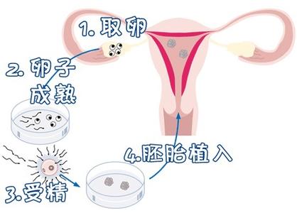 关于私人志愿者代孕服务怎么选